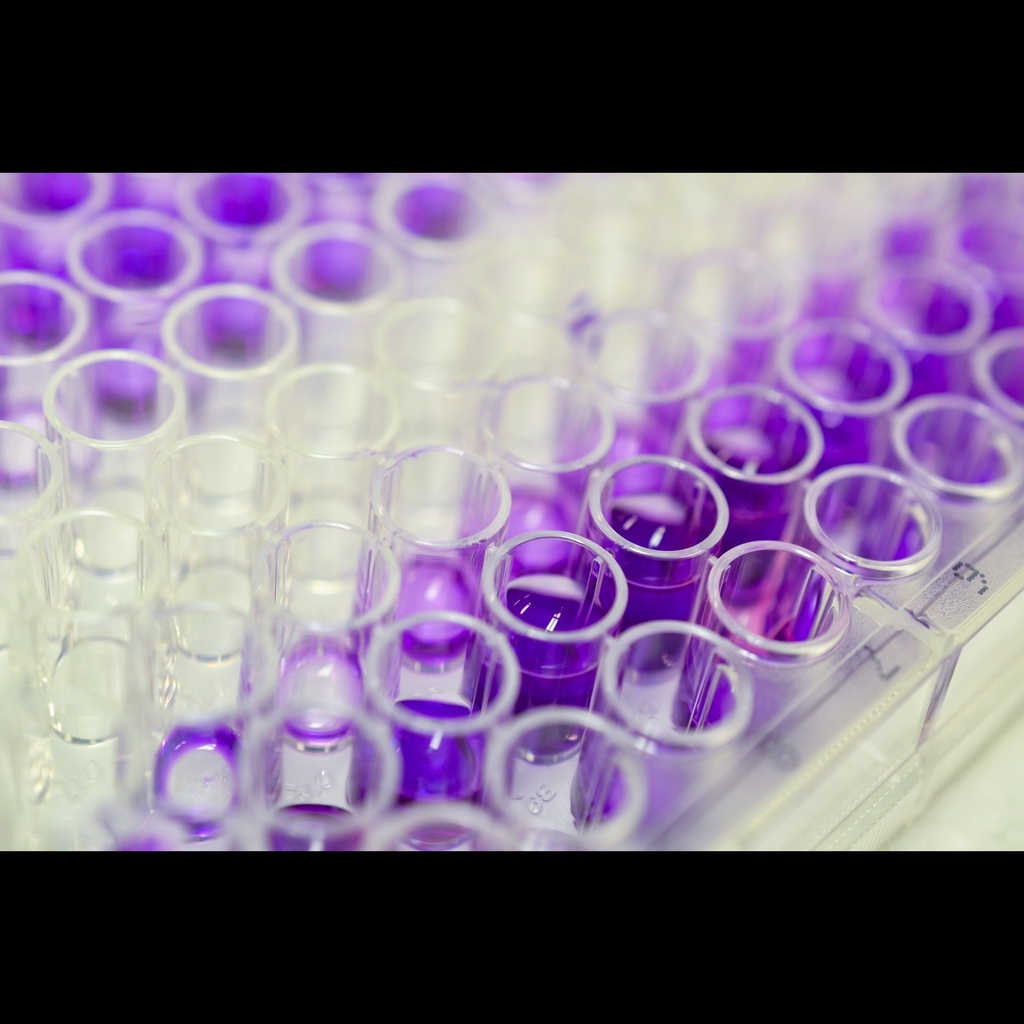 Human 27size:Hydroxycholesterol, 27size:OHC GENLISA ELISA size: 96 Tests